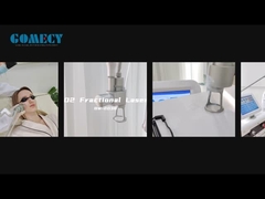 분자화탄소 레이저 피부 재생 피부 강화