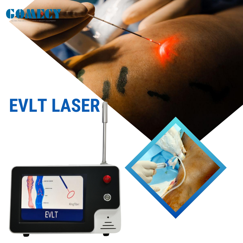 Euvlt Machine 980nm 1470nm Dual Wavelength Diode Laser Machine For Endovenous Vein ...